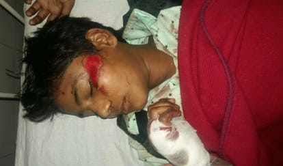 smriti irani does not pay attention to injured children