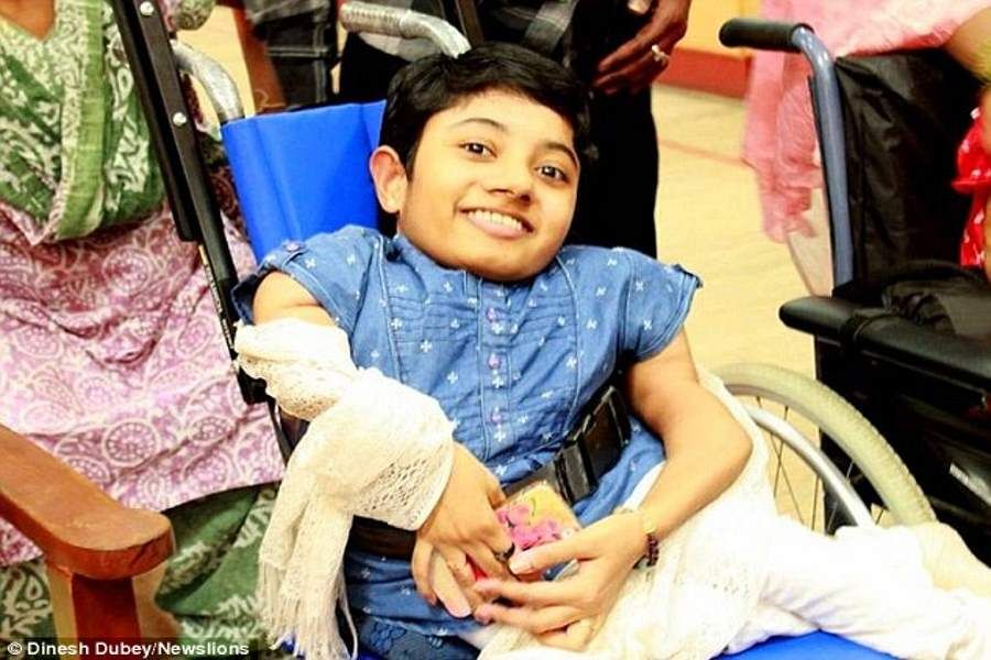 हैरतअंगेज बीमारीअब तक 300 फ्रैक्चर का हो चुकी है शिकार Brittle Bone Disease Amar Ujala