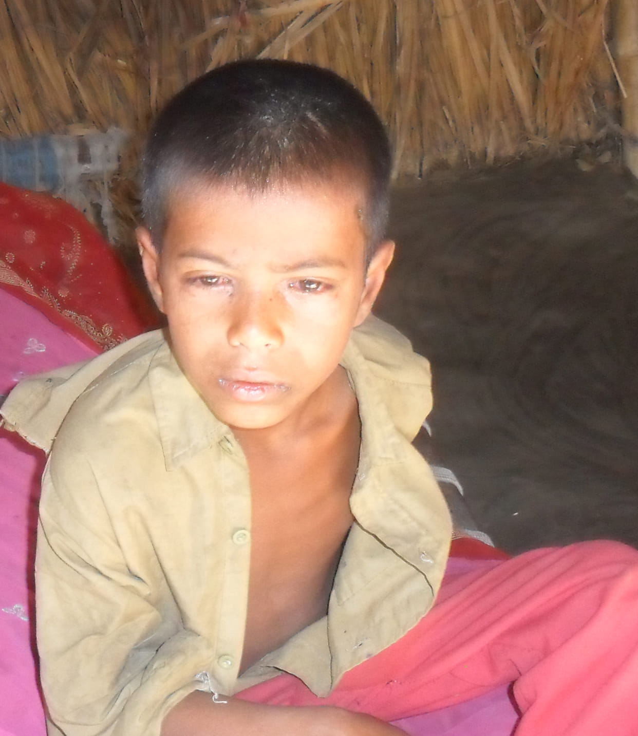 Ansari village hit by measles