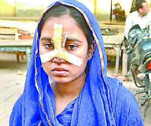 man cuts his wife's nose