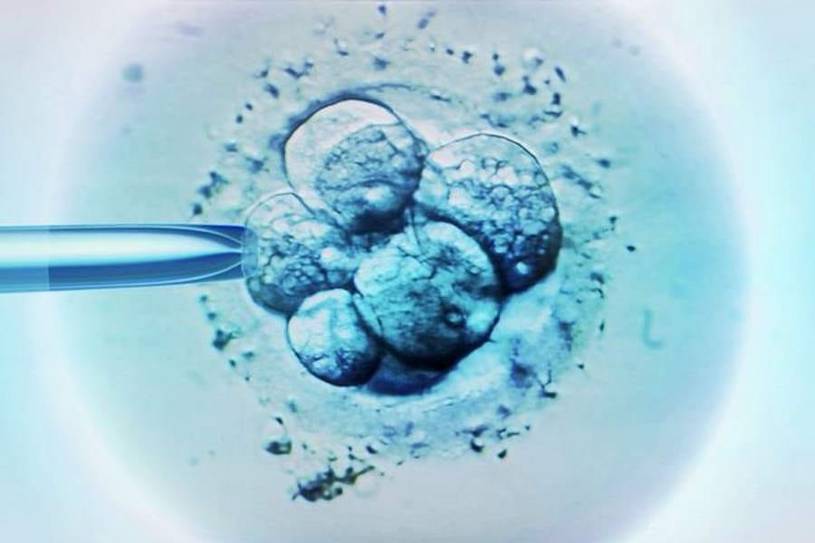 woman gives birth to twin from two different fathers