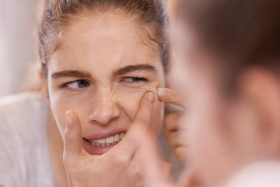 reason for men's acne know treatment and prevention