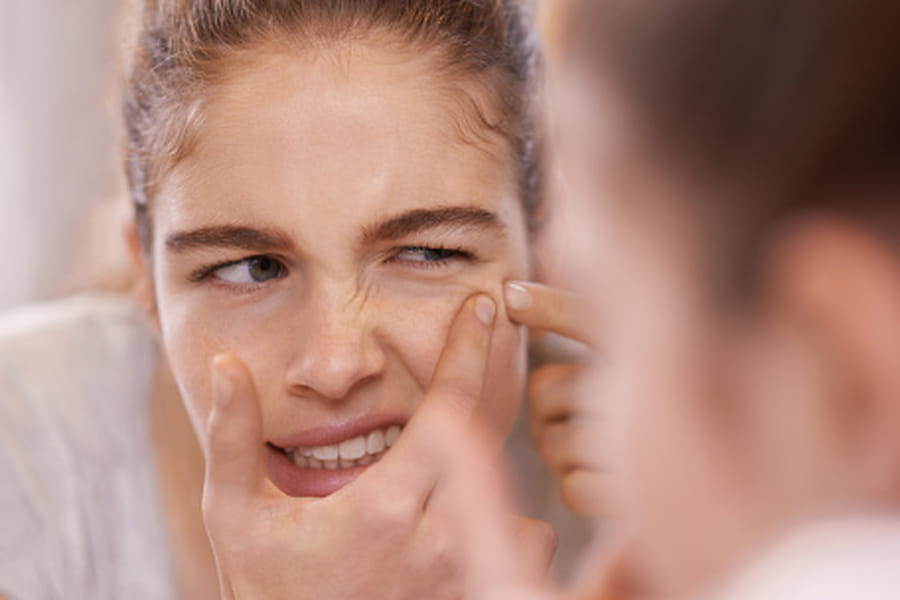reason for men's acne know treatment and prevention