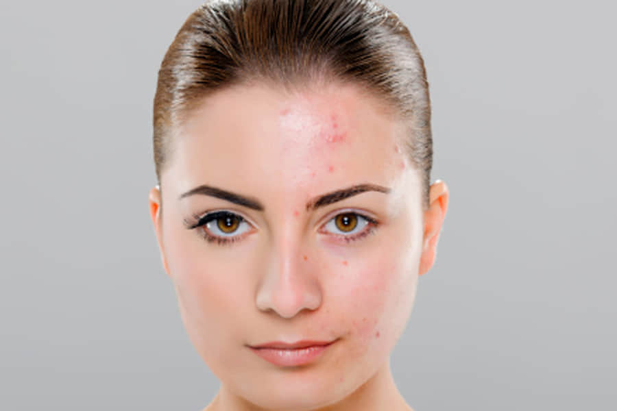 cinnamon powder benefits for every type of skin including acne prone to dry