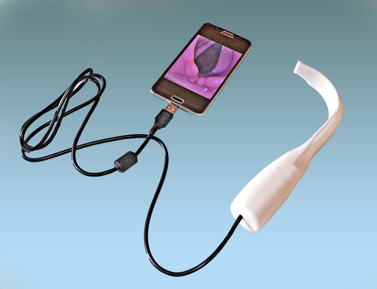 sgpgi doctor created smartphone laryngoscope