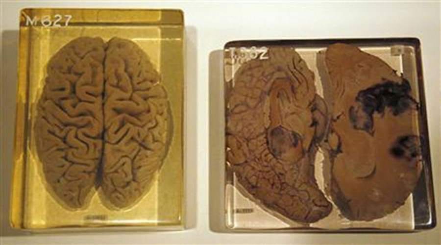 facts related to brain which you haven't heard of