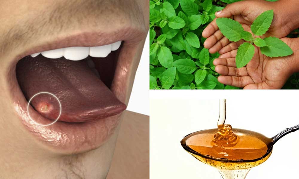 amazing benefits hibiscus flower