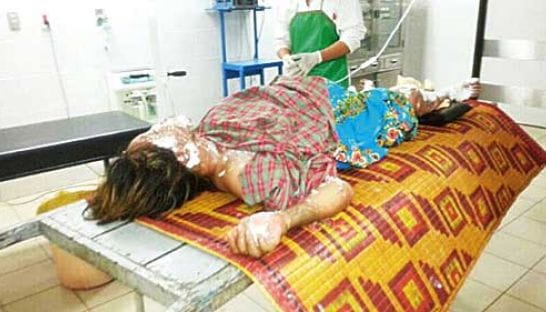 lady set on fire, sirsa lady fired, haryana lady fired, crime news, sirsa news, haryana news