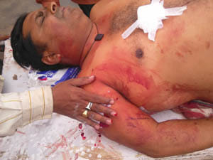 fire on father and son in khorabar