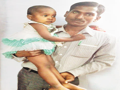 Symptoms of polio in children