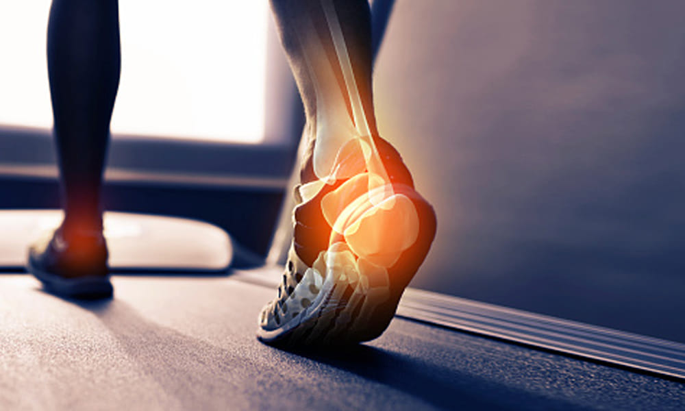 You Need to Operate If You Do Not Care of Foots