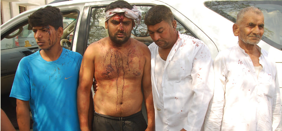 climbed car on child, because of police negligence commotion in the area