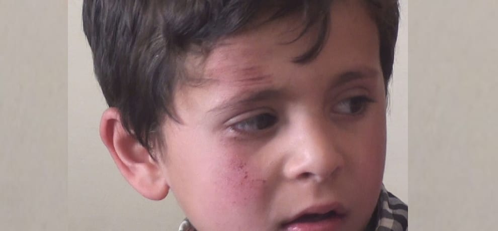  leopard attack on child at mandi.