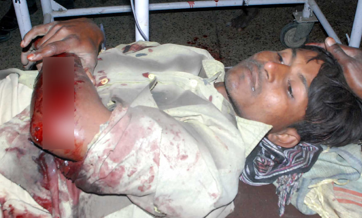 five people injured in the blast