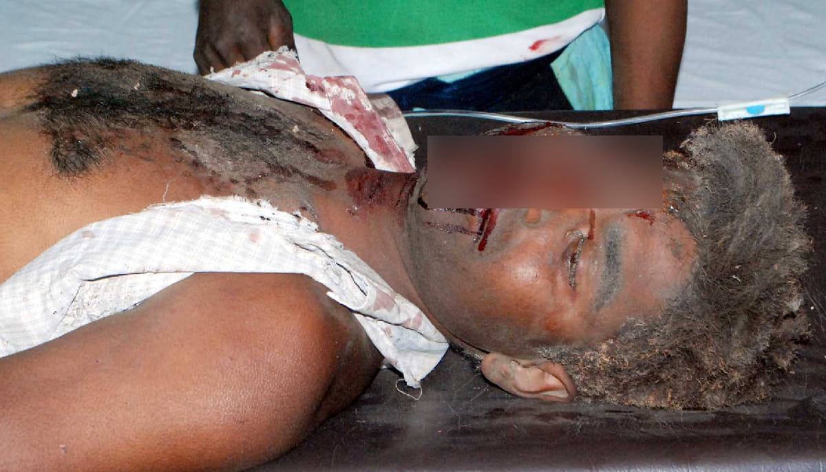 five people injured in the blast