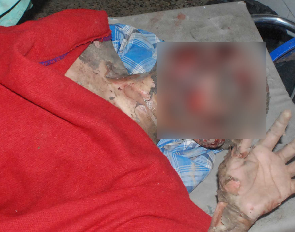 women injured in accident
