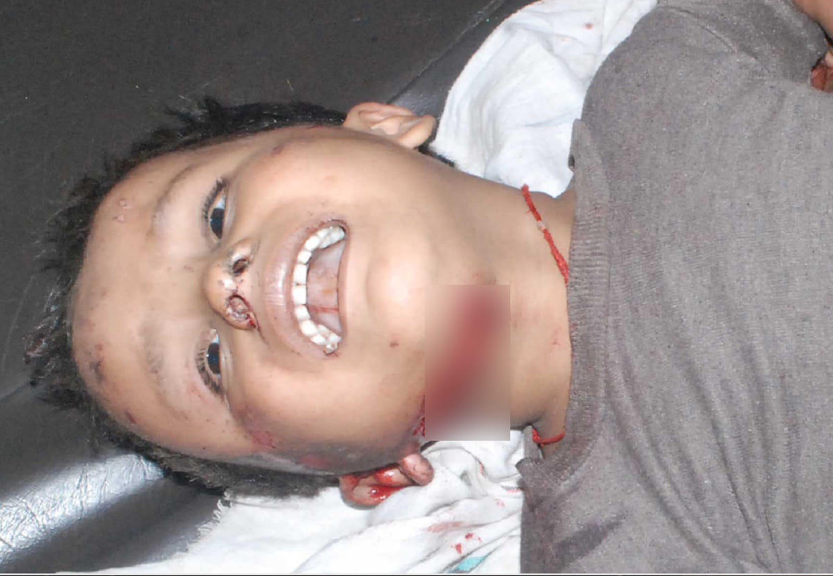 five people injured in the blast