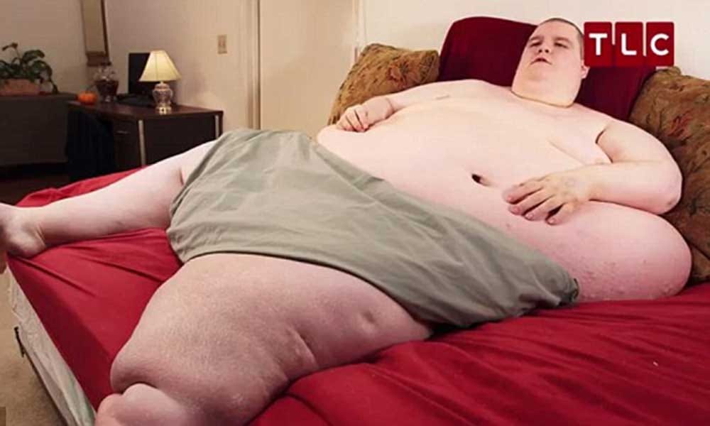 obese man of 400 kg tells his story