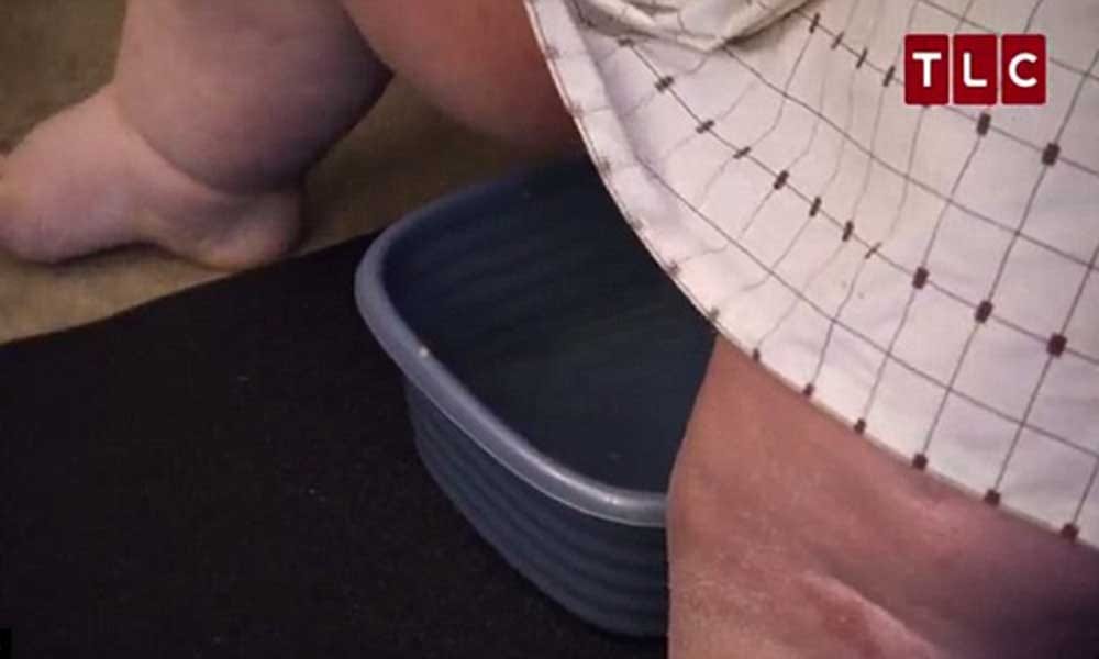 obese man of 400 kg tells his story
