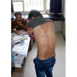central jail, amabala, haryana, third degree, torture