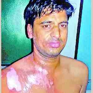 Bike riding miscreants threw acid on bank staff