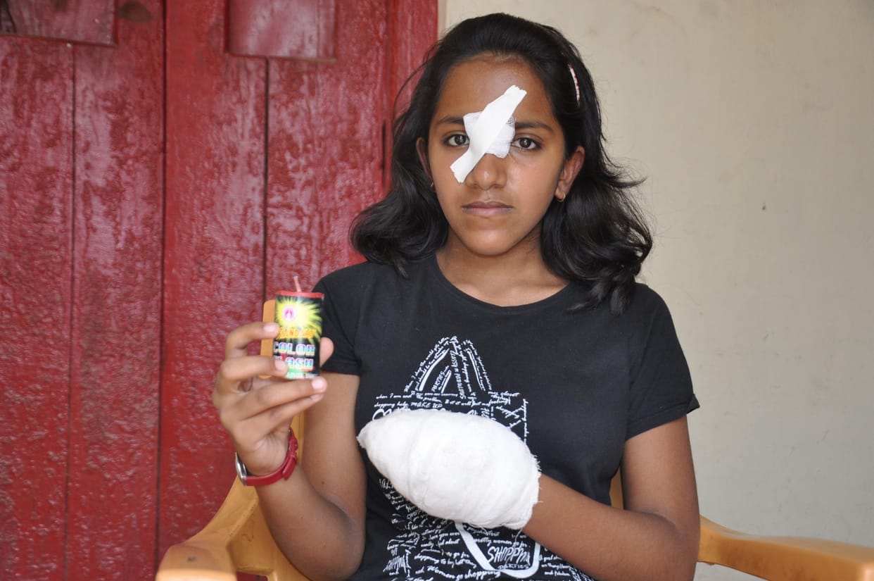 girl burn with colour cracker