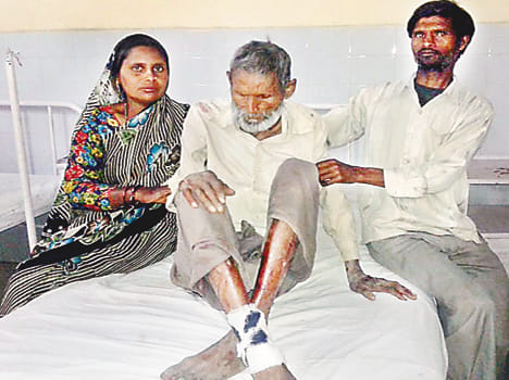 three person injured from wild animal