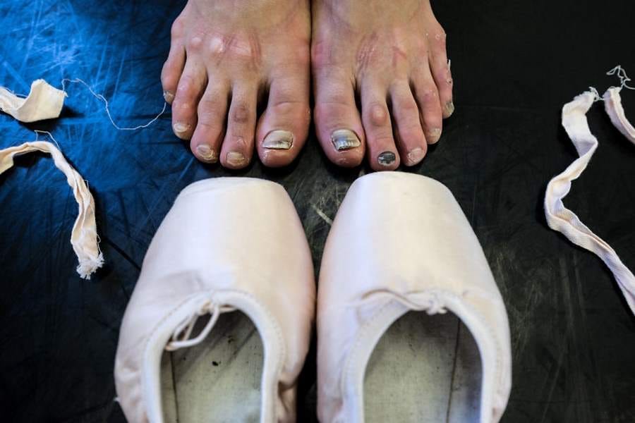 pain of becoming a ballet dancer