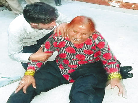 police beating