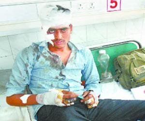 11 injured in accidents