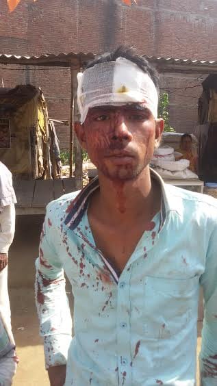 Violence in Conflict, the father-son injured