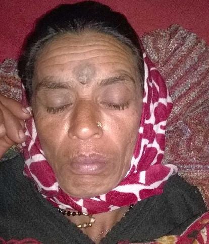The death of a woman being electrocuted, the second serious
