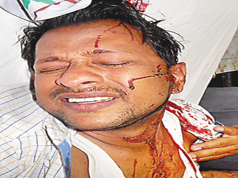  District Coordinator in dispute with a staff beaten