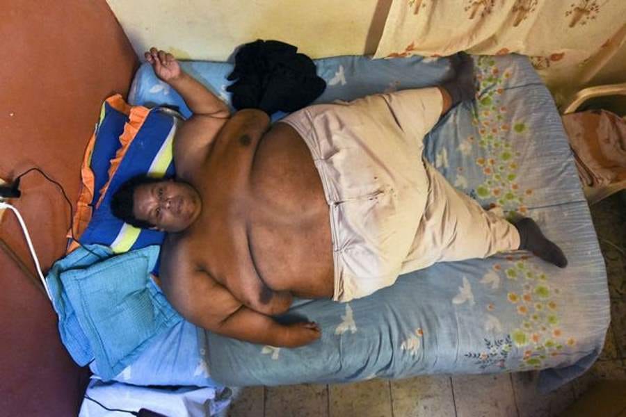 heaviest man in columbia wants to loose 300 kilos