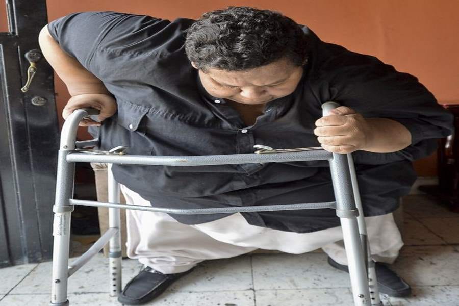 heaviest man in columbia wants to loose 300 kilos