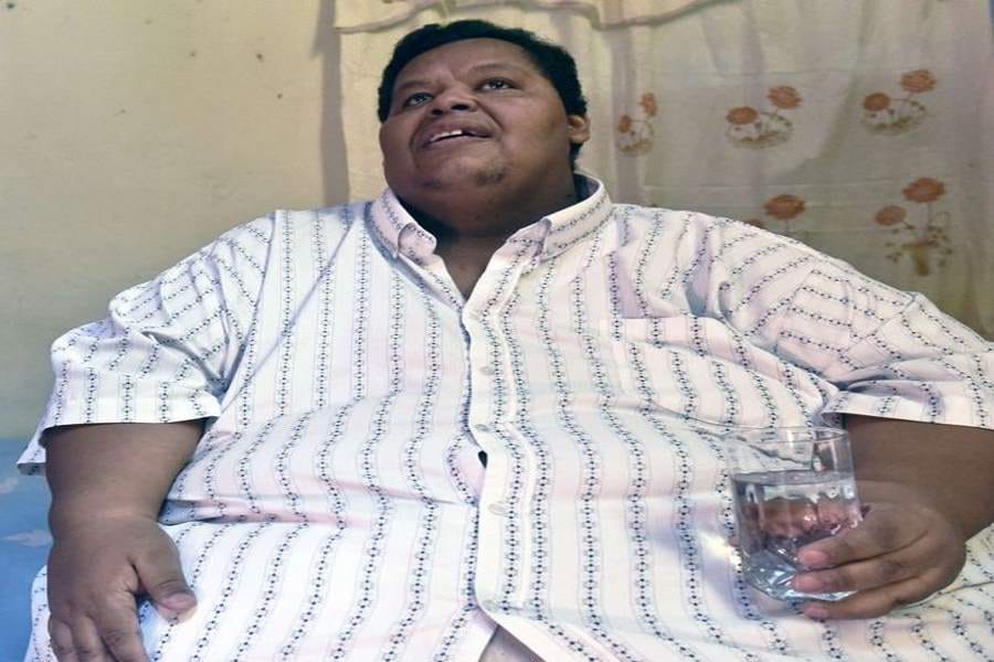 heaviest man in columbia wants to loose 300 kilos
