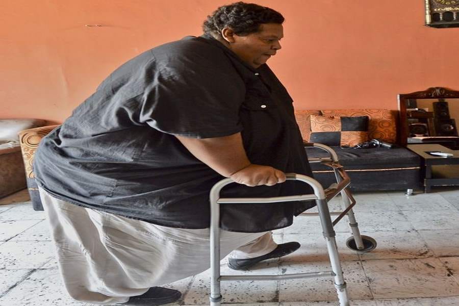heaviest man in columbia wants to loose 300 kilos