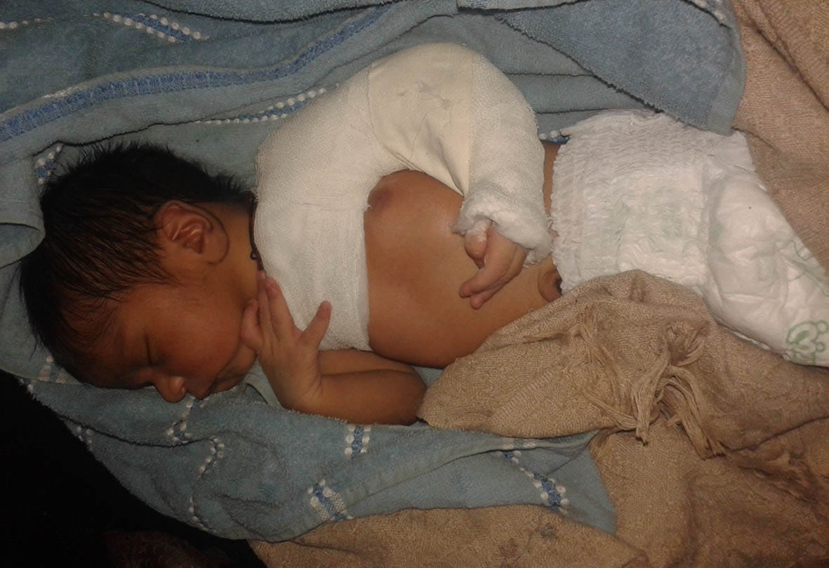 new born baby injured in hospital