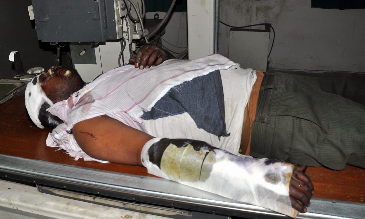 three women injuried in pickup accident