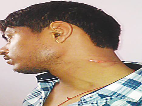Riding was hit by a car, beaten