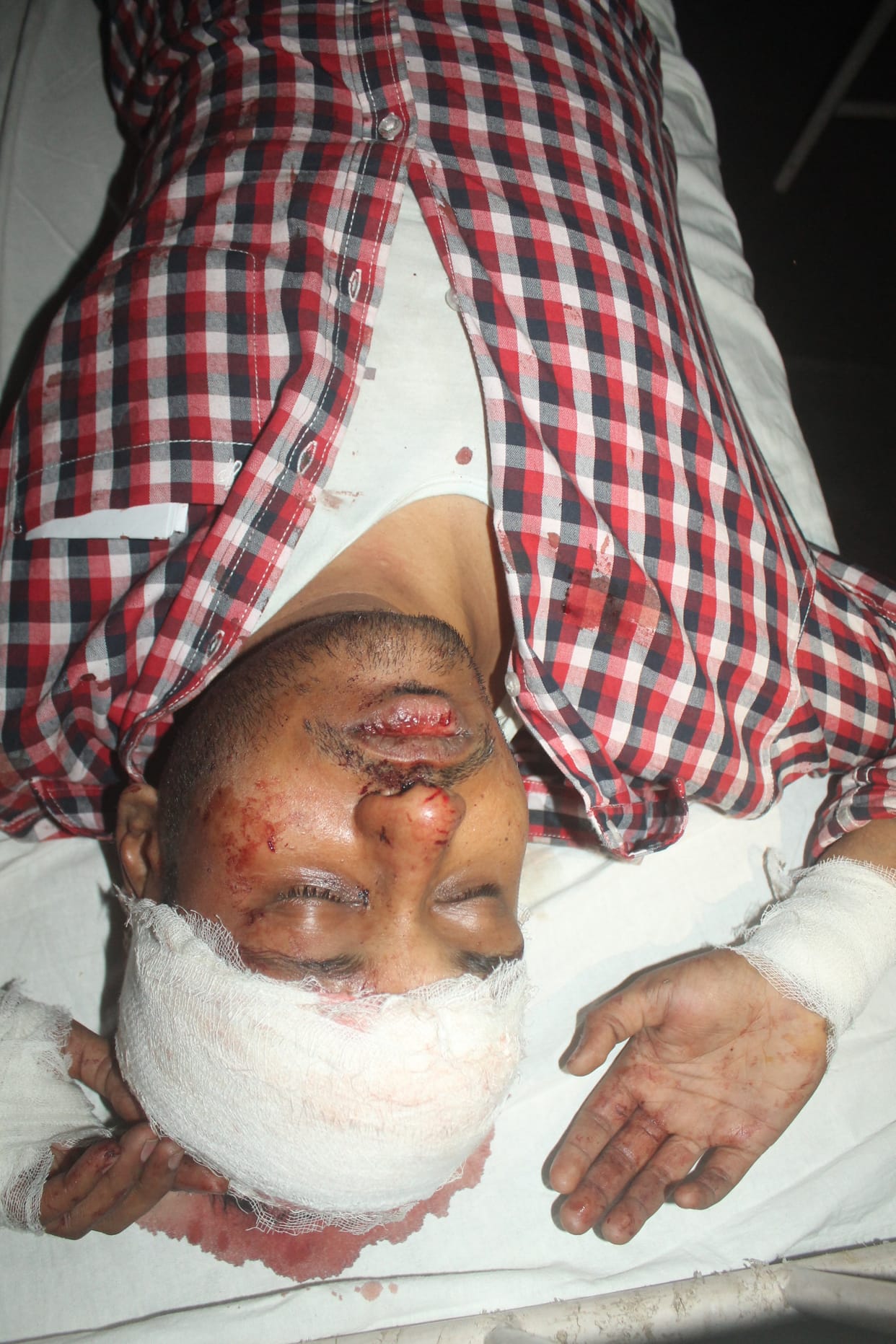 Six injured i