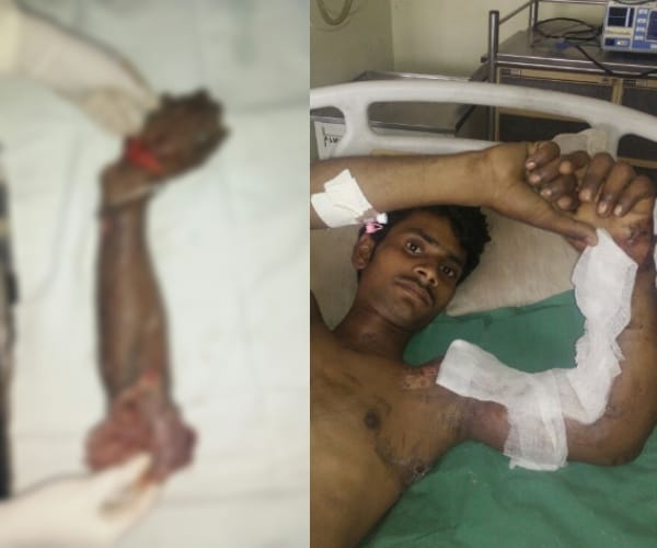 Big surgery by KGMU doctors.