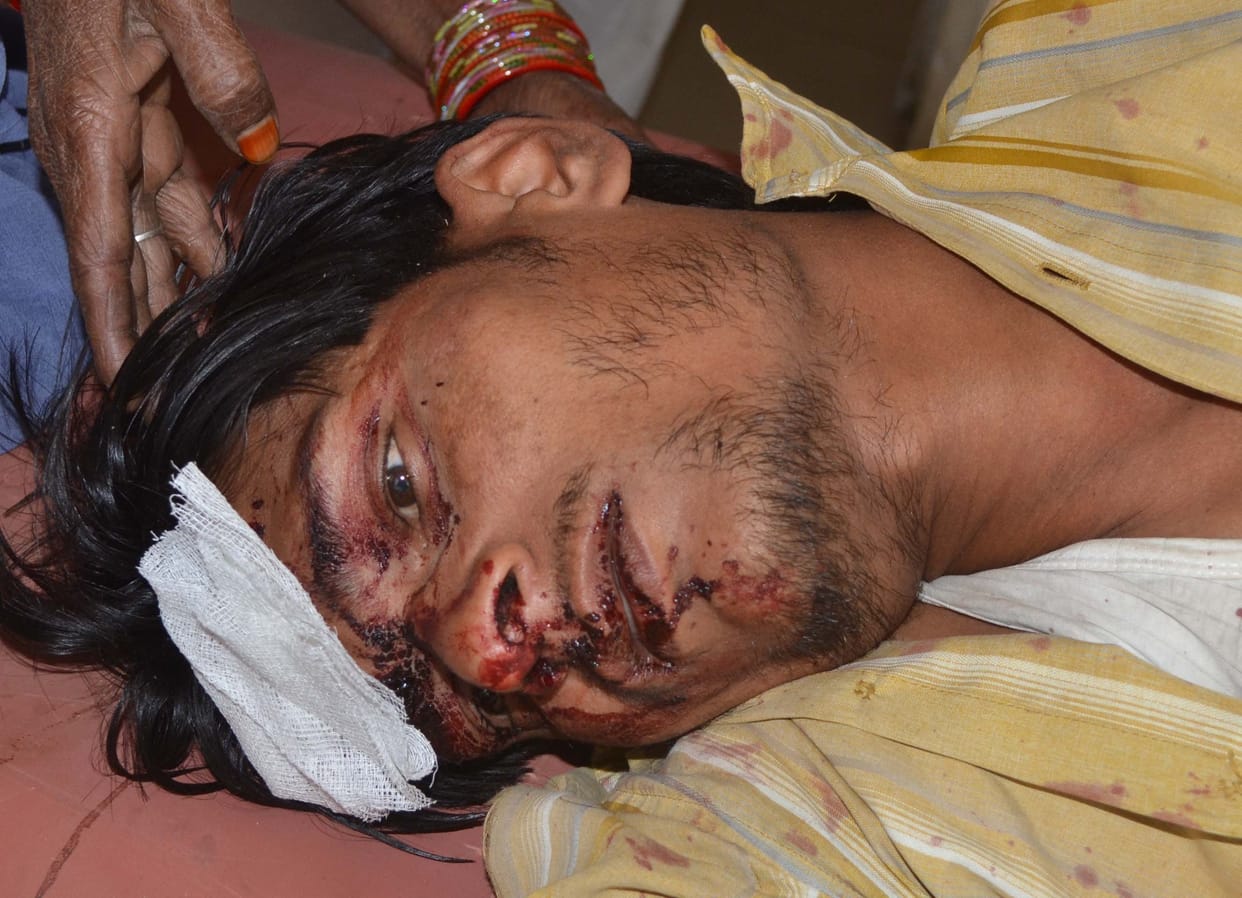 The injured young man hit by beaux