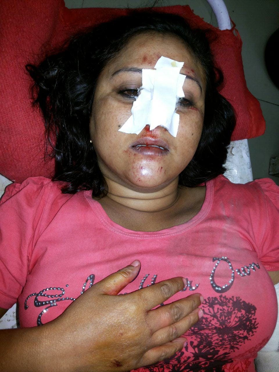 Married cylinder exploded, killing