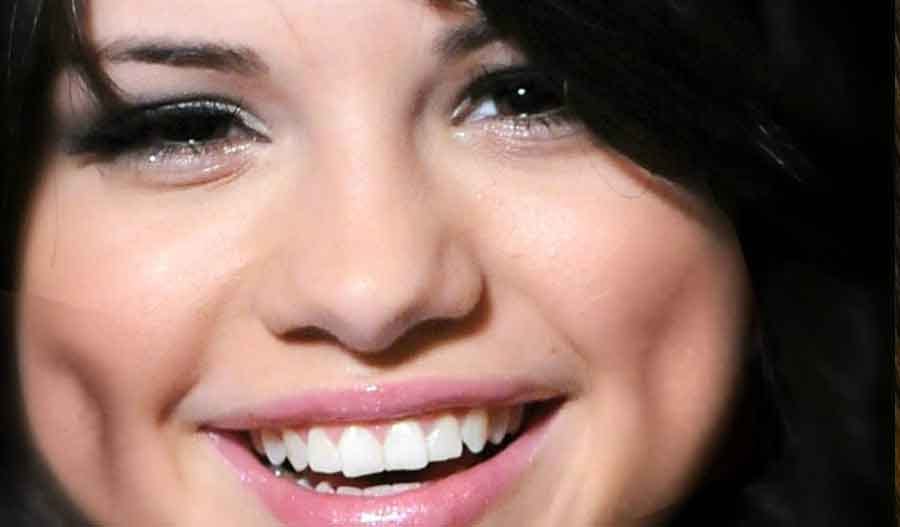 why do some people have dimples