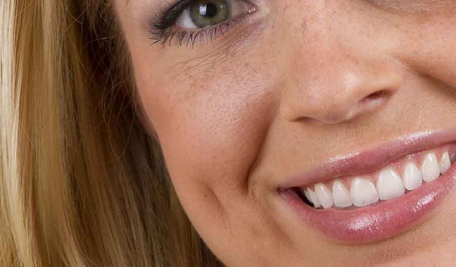 meaning of dimple on cheek 
