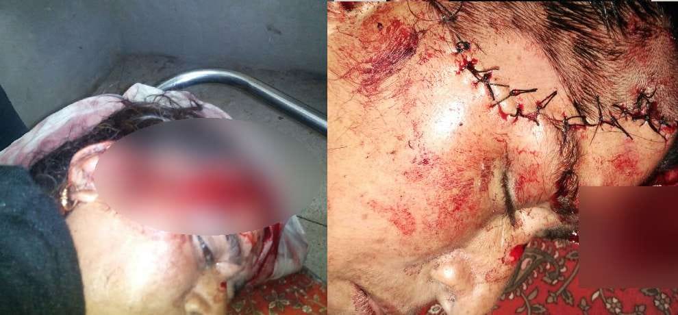 leopard attack on car in hamirpur woman injured