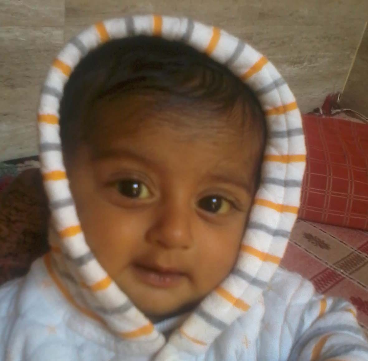 The death of seven-month-old baby with jaundice.