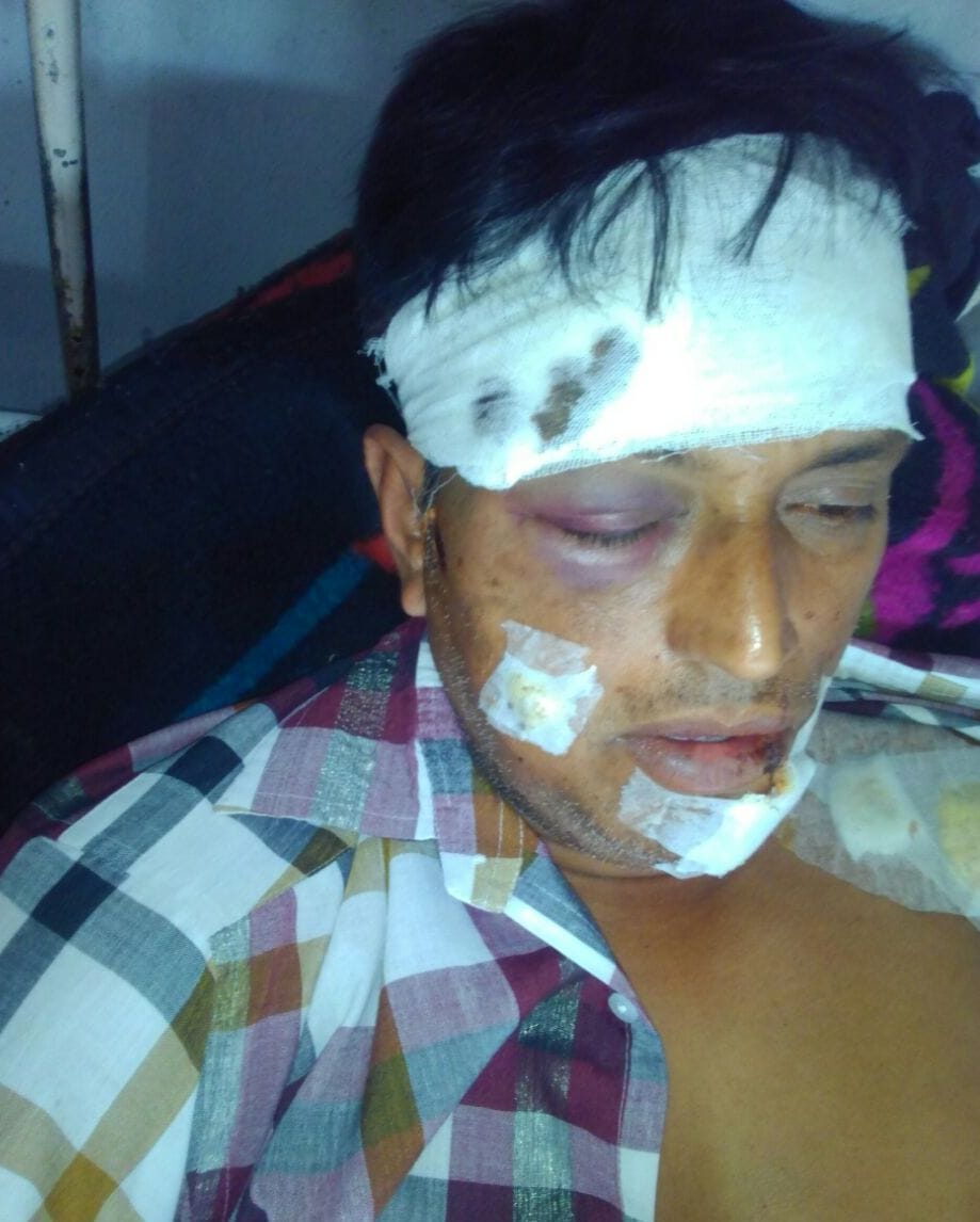 son and father beaten by group