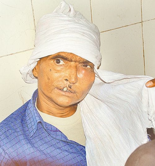 more budjet but no help for canser patient